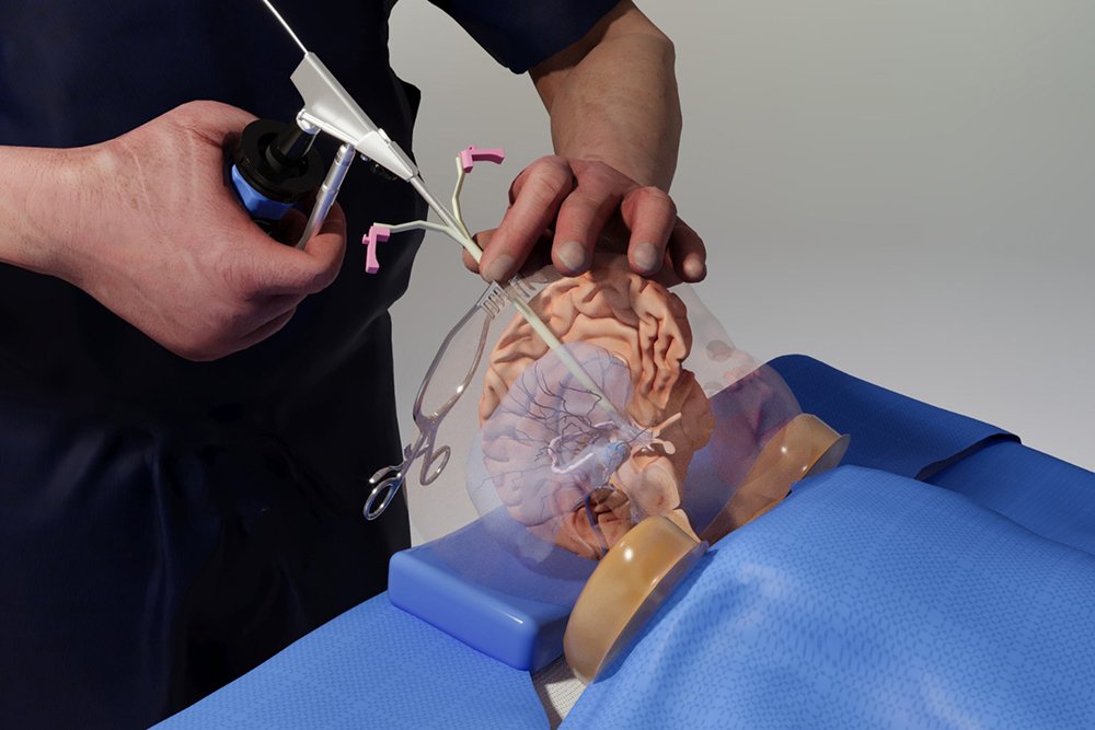 Surgeon practices endoscopic brain surgery techniques on a transparent anatomical brain and skull model using specialized neurosurgical instruments.