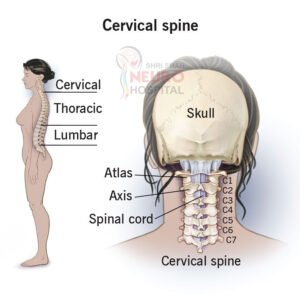 Best Cervical Spine Treatment in Bilaspur for neck pain, cervical slip disc, numbness, and advanced minimally invasive spine surgery by Dr Abhishek Kumar Shah
