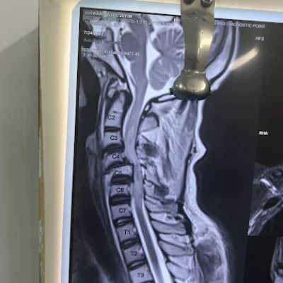 MRI scan of the cervical spine showing vertebrae labeled from C1 to T5 in a sagittal view, displayed on a lightbox in a clinical setting.